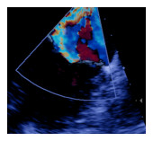 Echocardiography in Gainesville