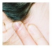 tmj, tmd, tmj problem and treatment