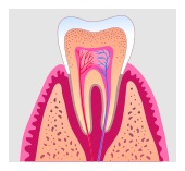 Hawthorne root canal