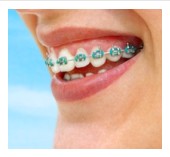 orthodontist in Mission